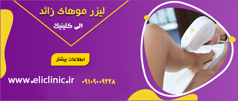 لیزر تهرانپارس